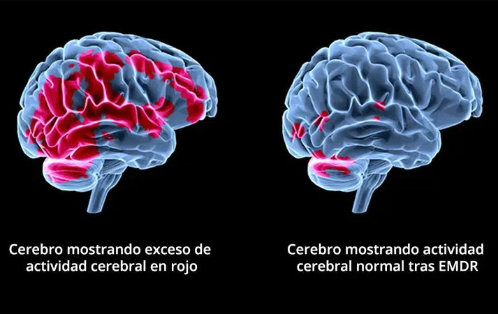 Core es nuestro maravilloso Golden de casi 8 años que nos asiste en terapias, especialmente si las emociones son las protagonistas.